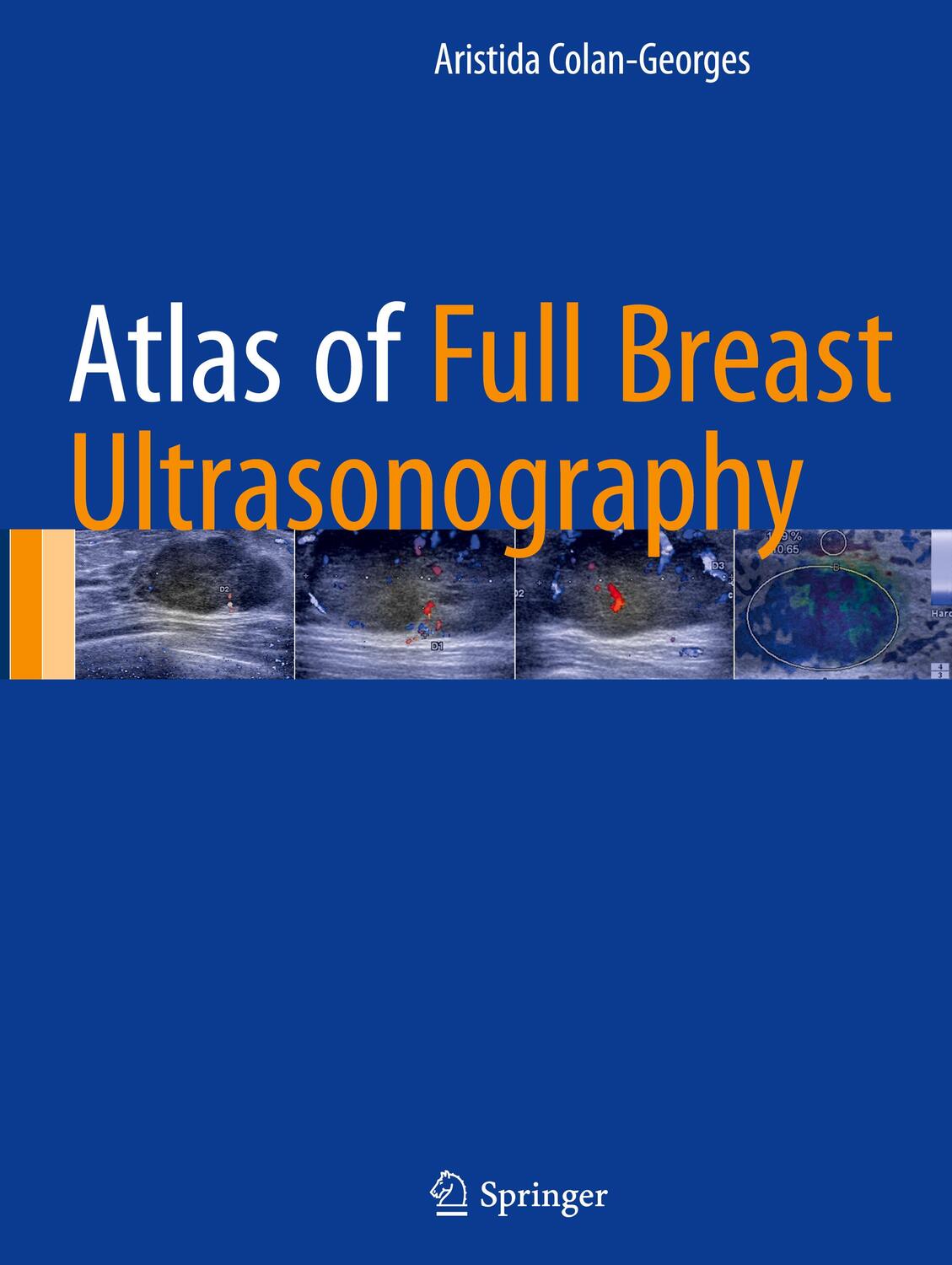 Cover: 9783319314174 | Atlas of Full Breast Ultrasonography | Aristida Colan-Georges | Buch