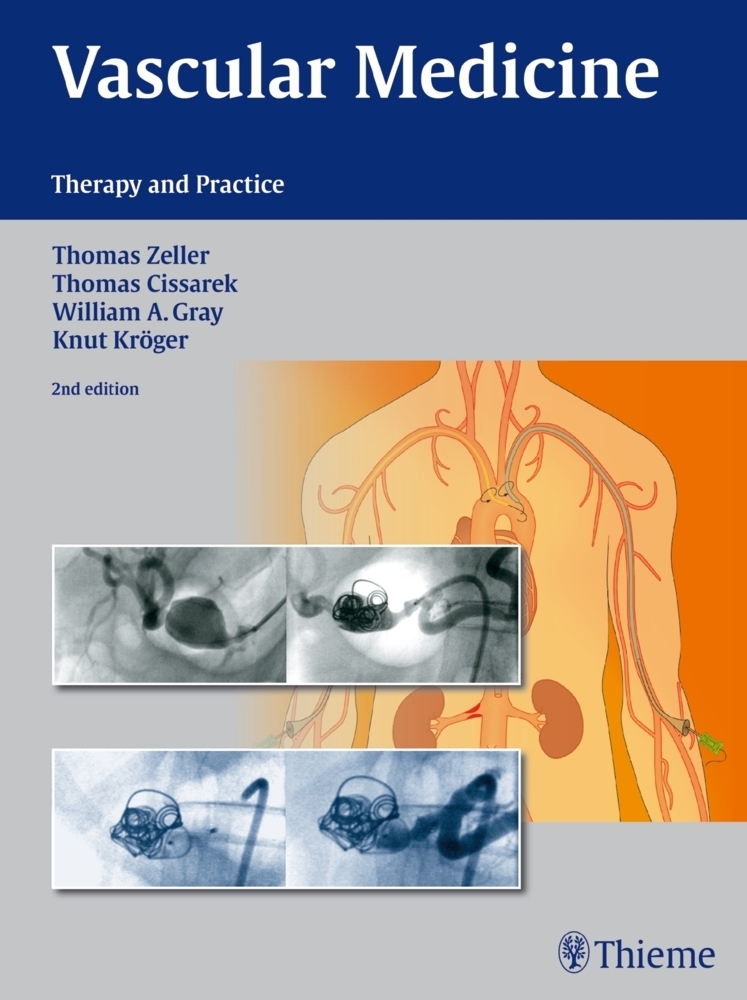 Cover: 9783131768414 | Vascular Medicine | Therapy and Practice | Thomas Zeller (u. a.)