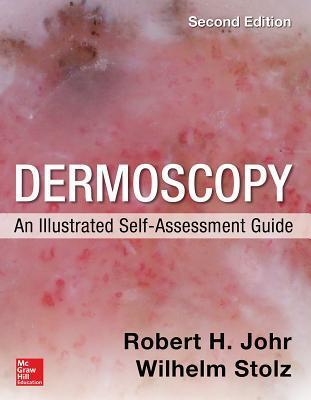 Cover: 9780071834346 | Dermoscopy: An Illustrated Self-Assessment Guide, 2/E | Johr (u. a.)