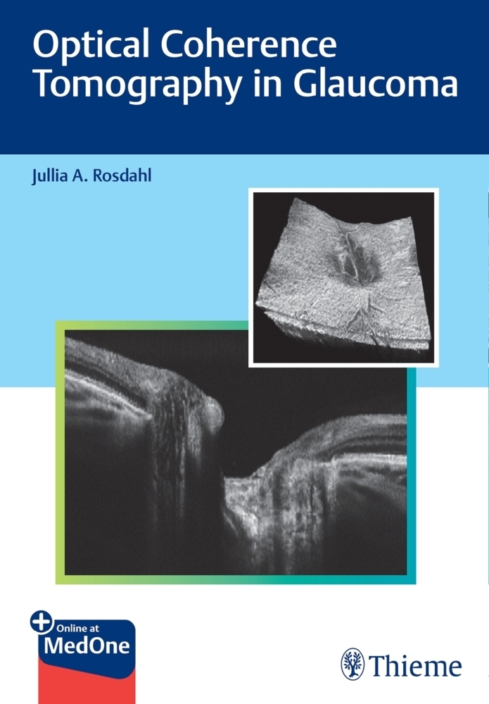Cover: 9781684202478 | Optical Coherence Tomography in Glaucoma | Jullia Rosdahl | Bundle