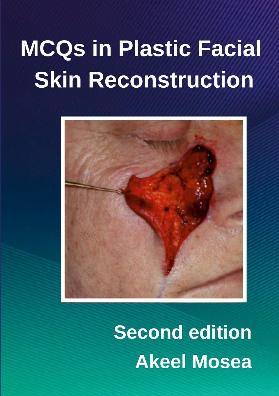 Cover: 9781326328412 | MCQs in Plastic Facial Skin Reconstruction | Akeel Mosea | Taschenbuch