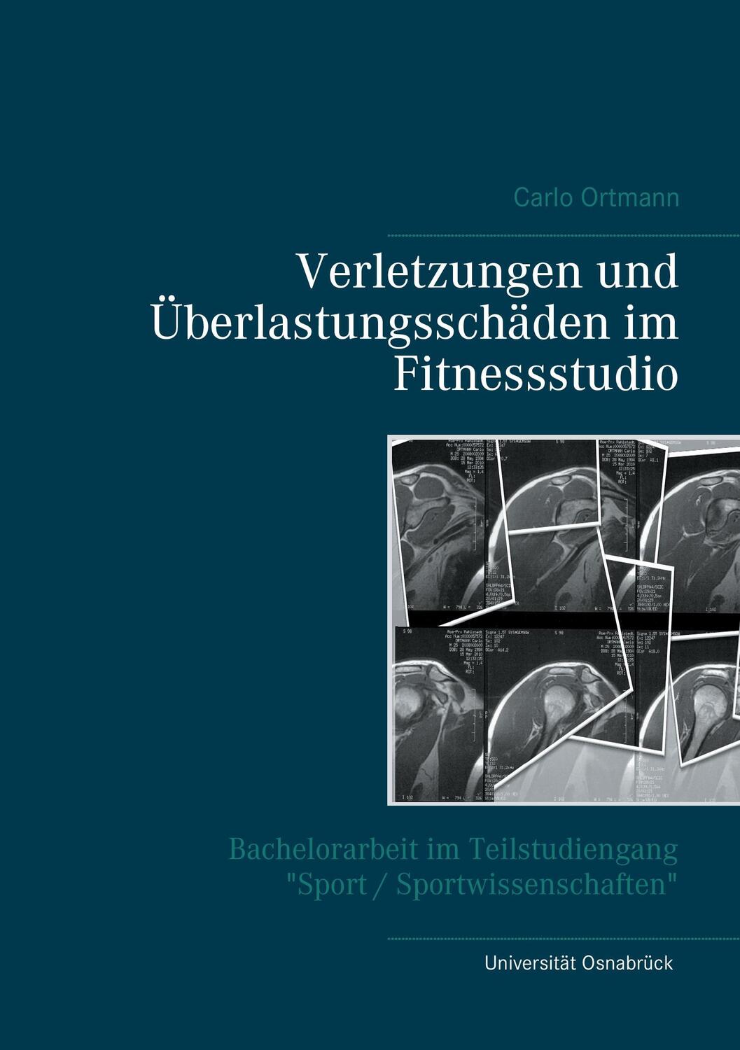 Cover: 9783743111493 | Verletzungen und Überlastungsschäden im Fitnessstudio | Carlo Ortmann