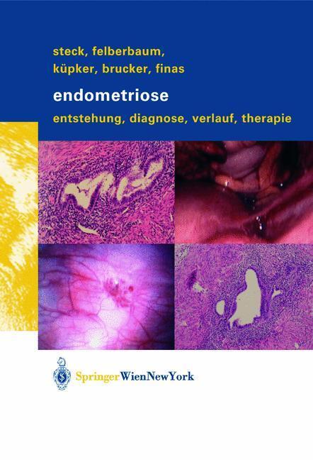 Cover: 9783709171967 | Endometriose | Entstehung, Diagnose, Verlauf und Therapie | Buch