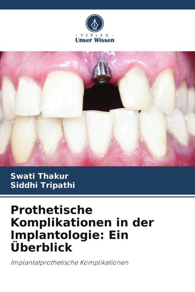 Cover: 9786205452677 | Prothetische Komplikationen in der Implantologie: Ein Überblick | Buch