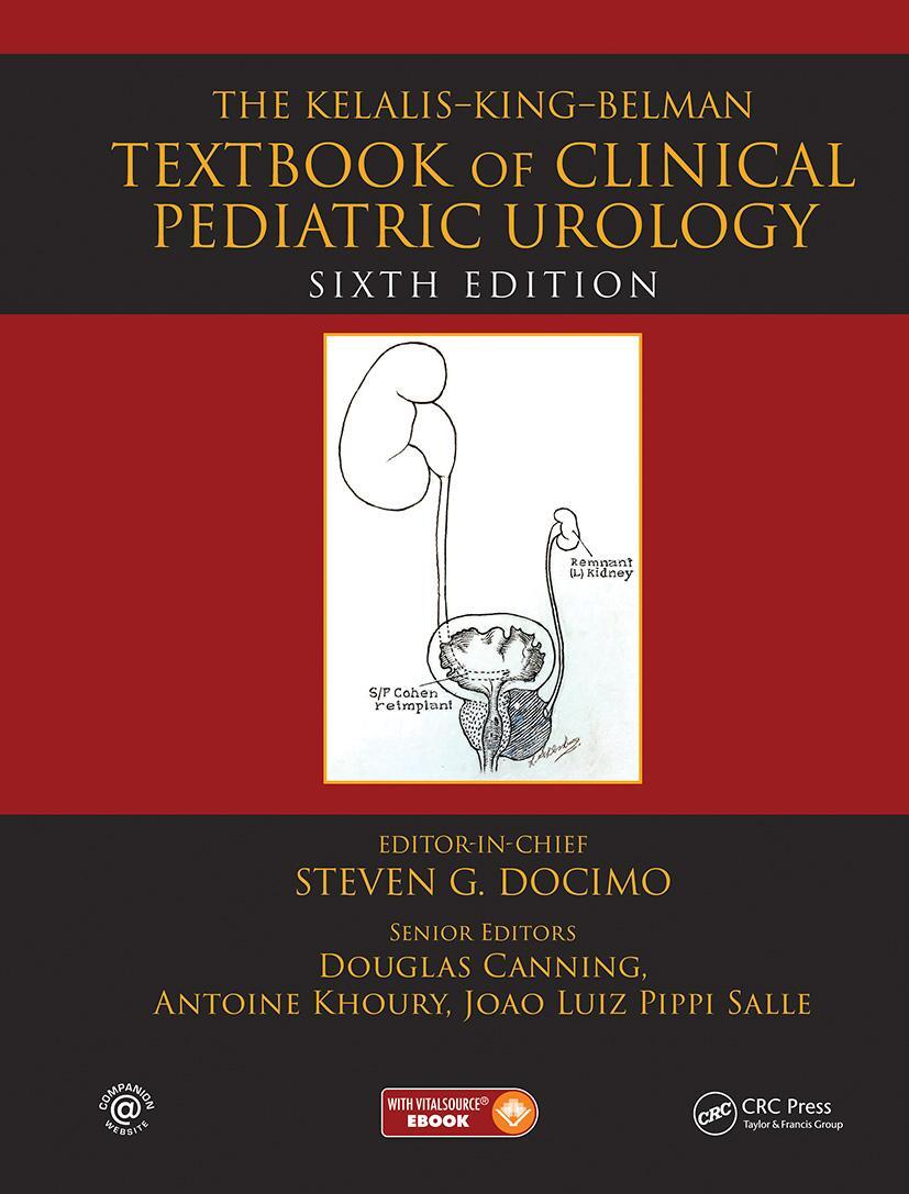 Cover: 9781482219470 | The Kelalis--King--Belman Textbook of Clinical Pediatric Urology