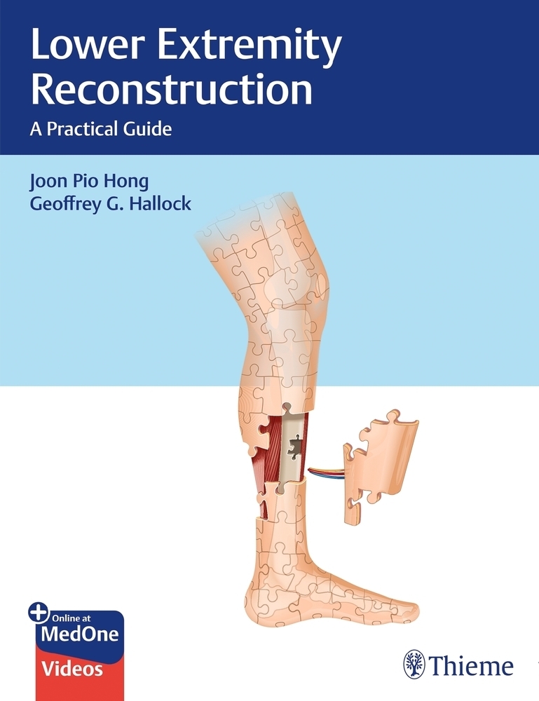 Cover: 9781626238084 | Lower Extremity Reconstruction | A Practical Guide. With E-Book | 2021