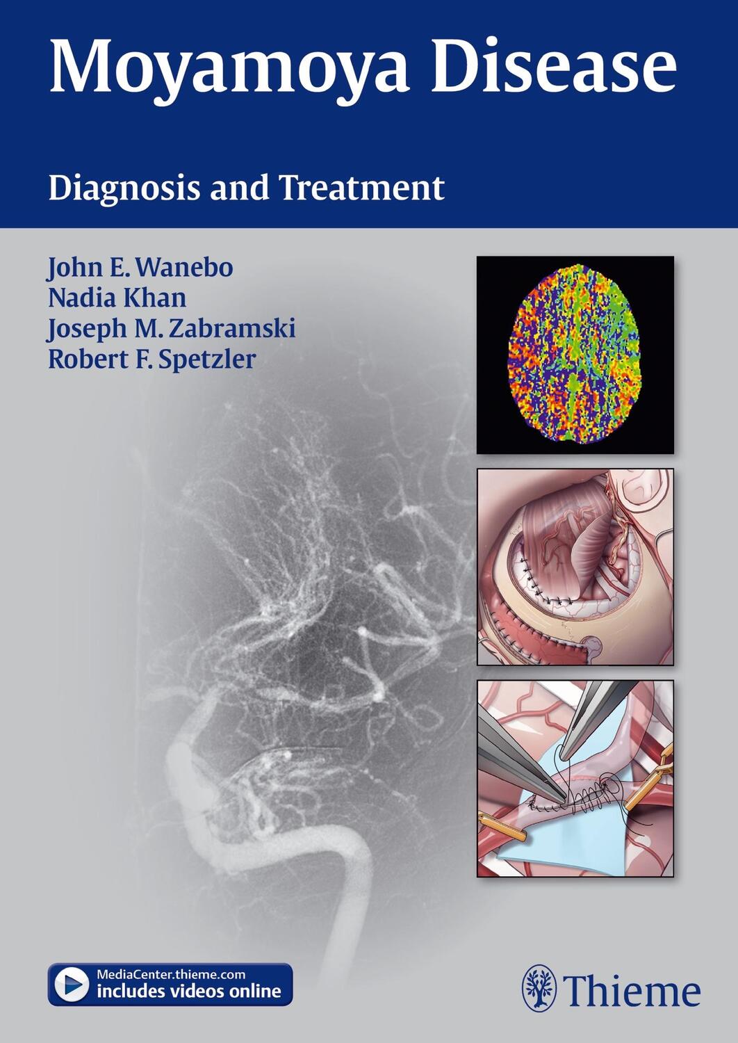 Cover: 9781604067309 | Moyamoya Disease: Diagnosis and Treatment | John E. Wanebo (u. a.)