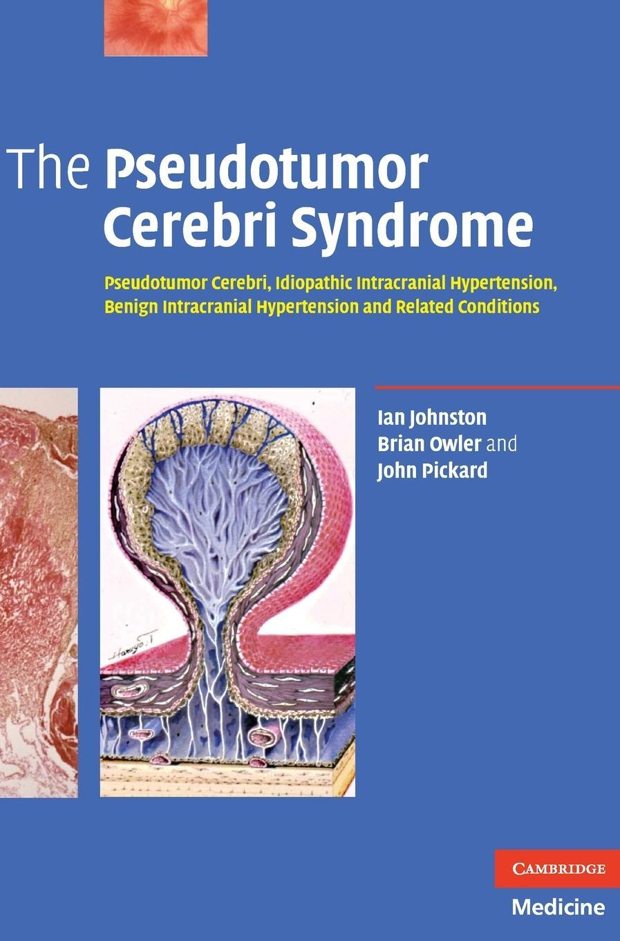 Cover: 9780521869195 | The Pseudotumor Cerebri Syndrome | Ian Johnston (u. a.) | Buch | 2007
