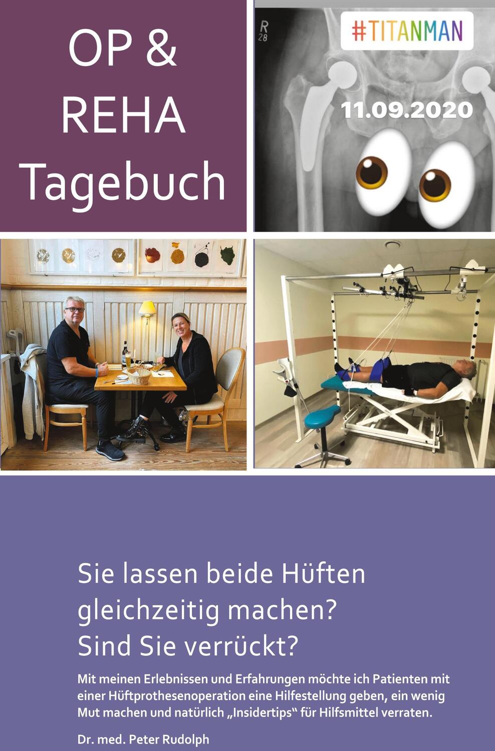 Cover: 9783961039371 | OP- und Reha-Tagebuch | Peter Rudolph | Taschenbuch | Rediroma-Verlag