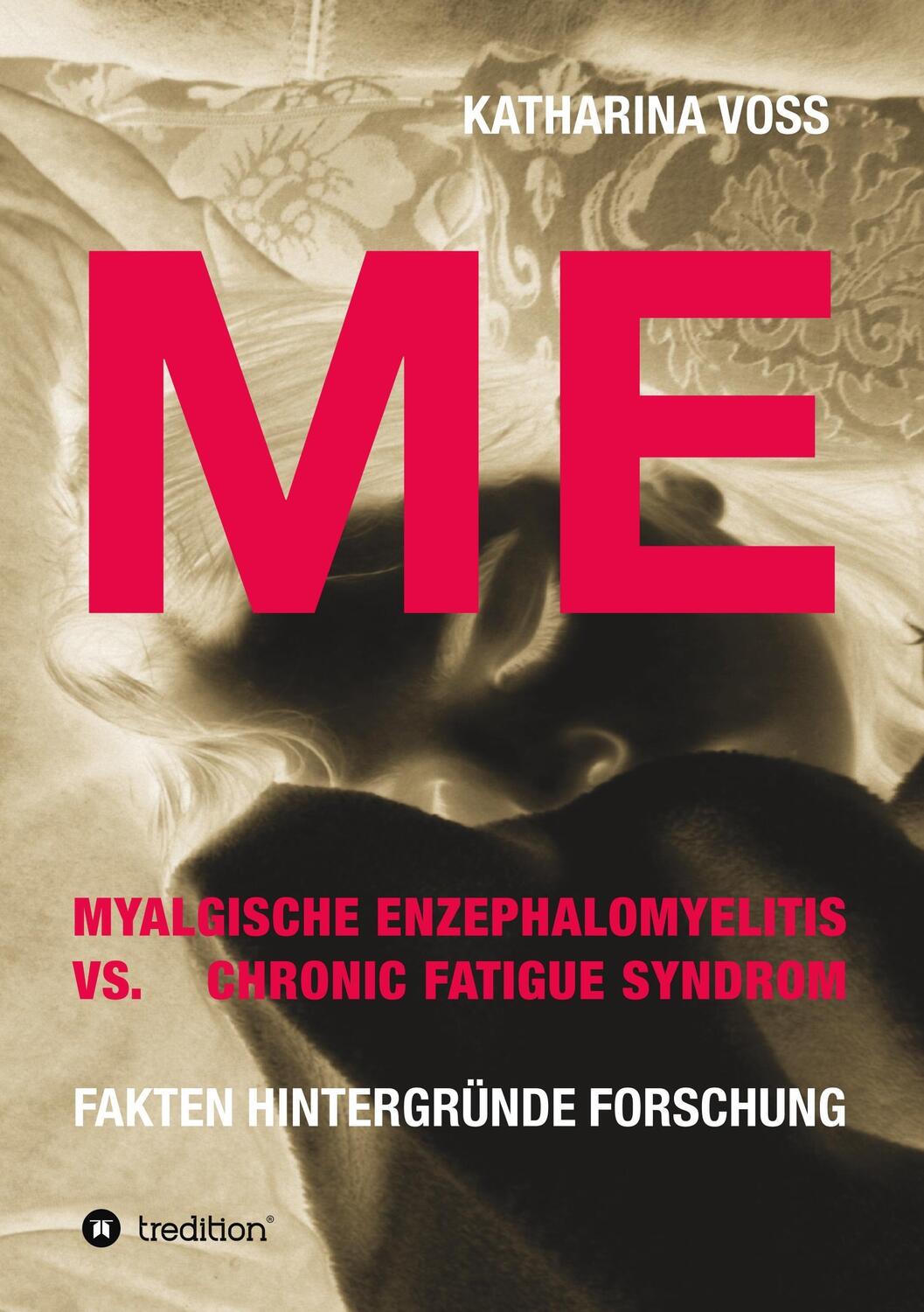 Cover: 9783743924949 | ME - Myalgische Enzephalomyelitis vs. Chronic Fatigue Syndrom | Voss