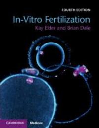Cover: 9781108441810 | In-Vitro Fertilization | Brian Dale (u. a.) | Taschenbuch | Englisch