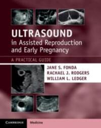 Cover: 9781108810210 | Ultrasound in Assisted Reproduction and Early Pregnancy | Taschenbuch