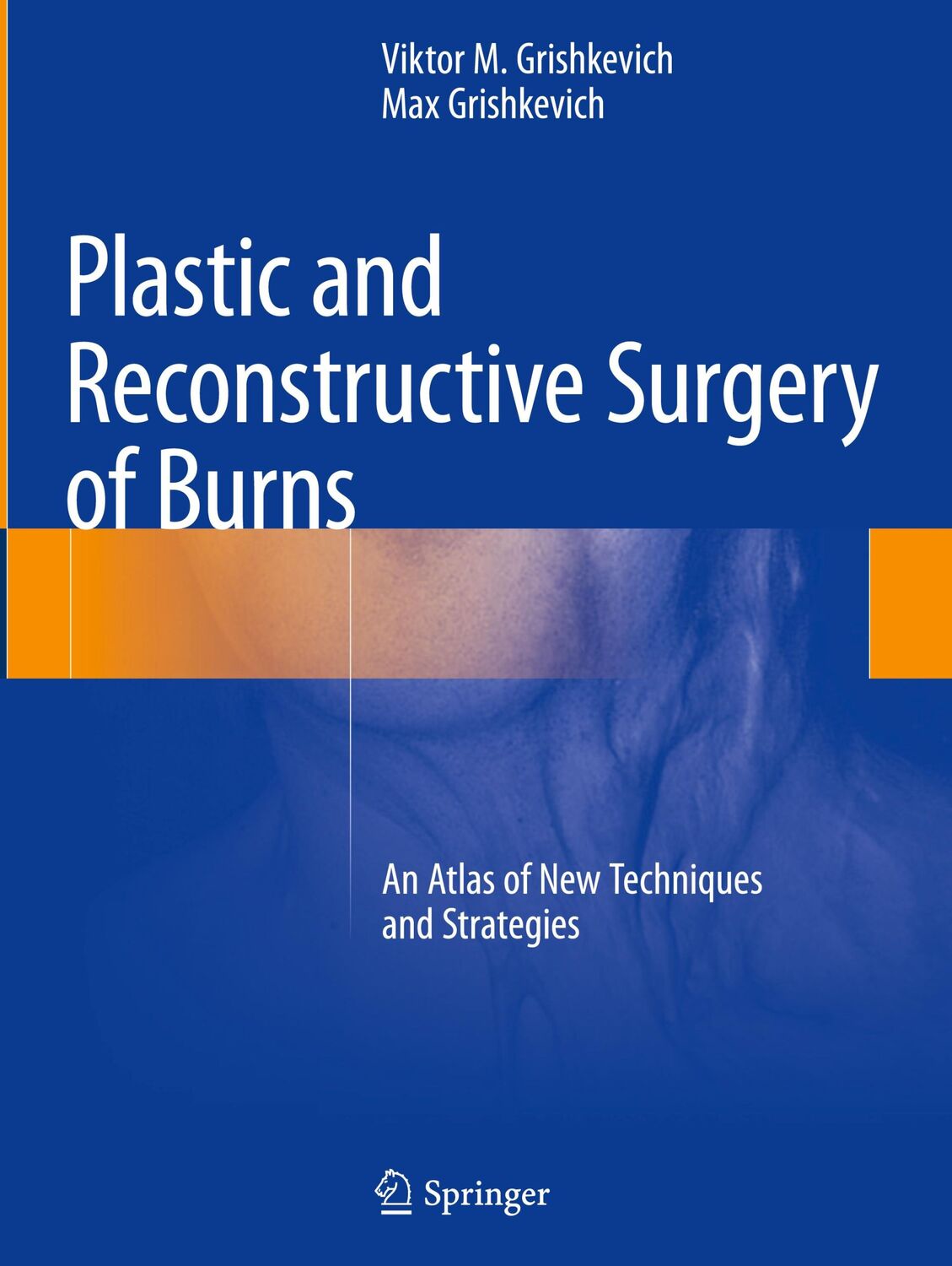 Cover: 9783319787138 | Plastic and Reconstructive Surgery of Burns | Max Grishkevich (u. a.)