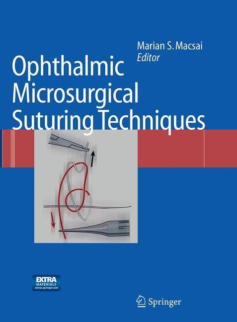 Cover: 9783662500316 | Ophthalmic Microsurgical Suturing Techniques | Marian S. Macsai | Buch