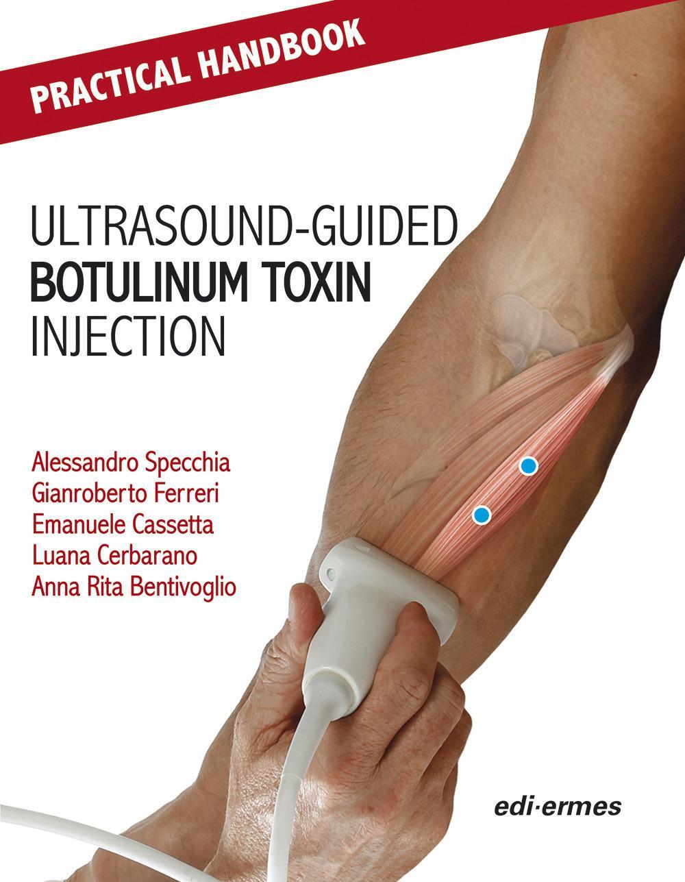 Cover: 9788870517170 | Practical Handbook for Ultrasound-guided Botulinum Toxin Injection
