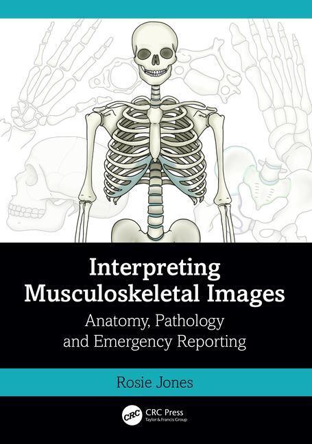 Cover: 9781032398914 | Interpreting Musculoskeletal Images | Rosie Jones | Taschenbuch | 2023