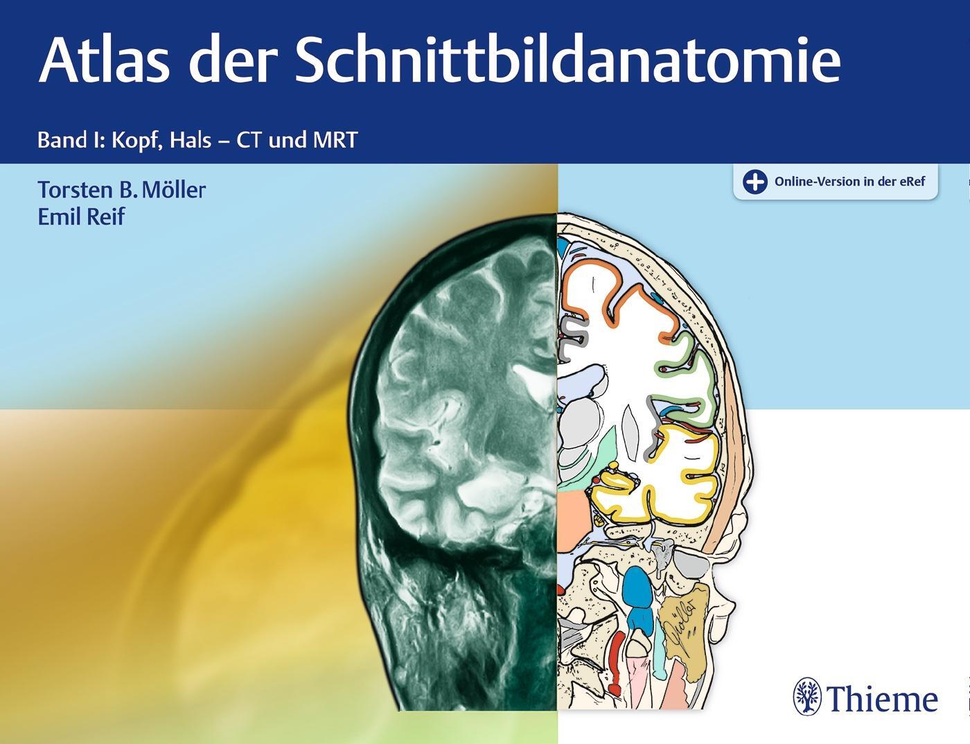 Cover: 9783132032217 | Atlas der Schnittbildanatomie. Band 01 | Torsten Bert Möller (u. a.)