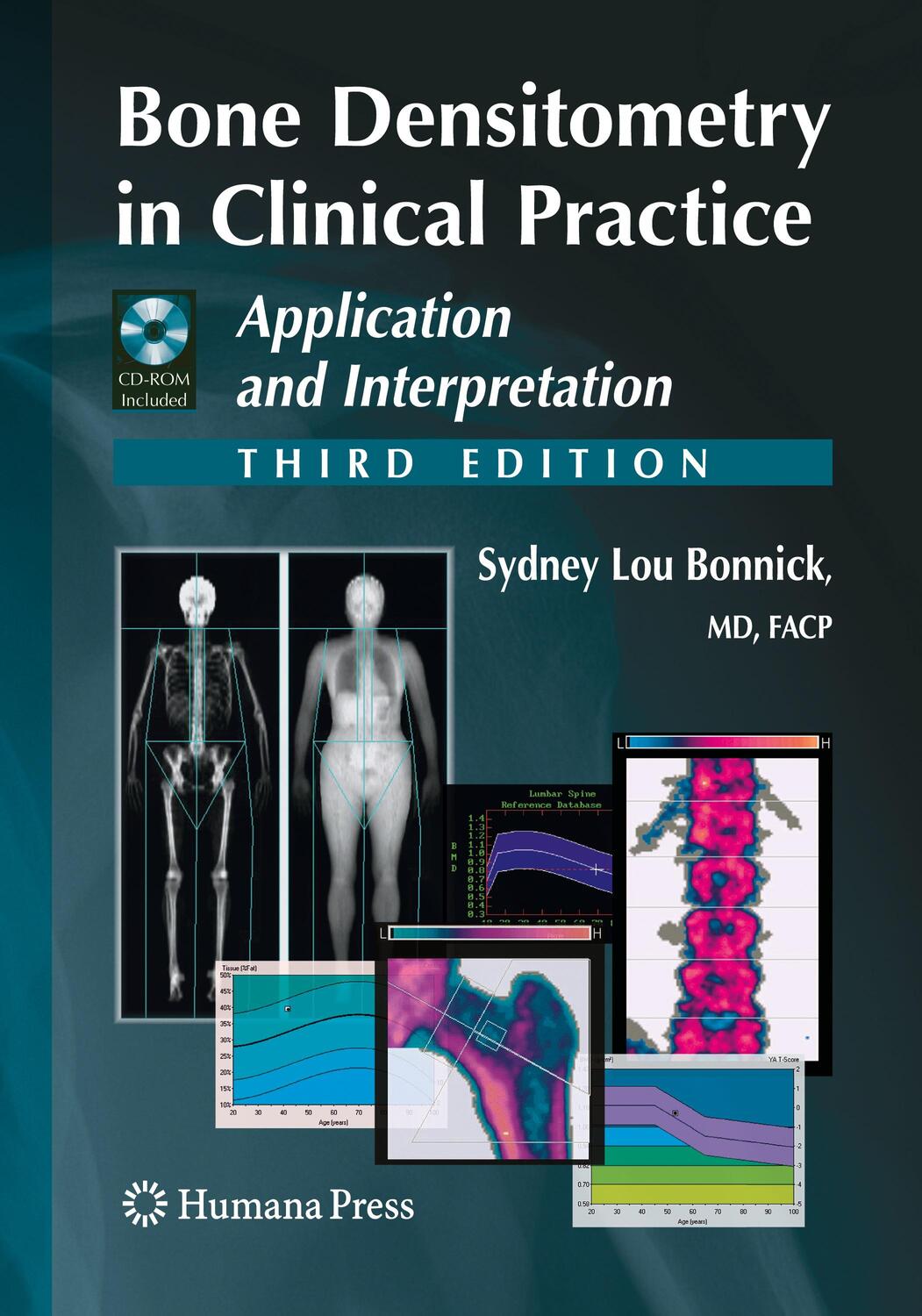 Cover: 9781493960910 | Bone Densitometry in Clinical Practice | Sydney Lou Bonnick | Buch