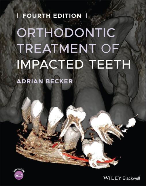 Cover: 9781119565376 | Orthodontic Treatment of Impacted Teeth | Adrian Becker | Buch | 2022