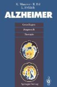 Cover: 9783540569329 | Alzheimer | Grundlagen, Diganostik, Therapie | K. Maurer (u. a.)