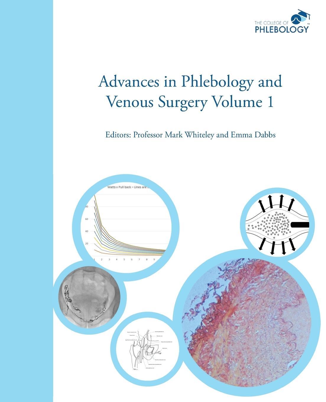 Cover: 9781908586032 | Advances in Phlebology and Venous Surgery Volume 1 | Emma Dabbs | Buch