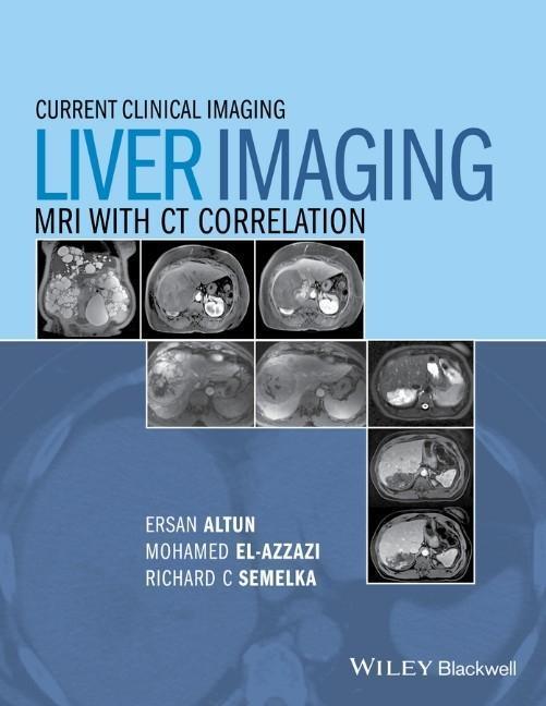 Cover: 9780470906255 | Liver Imaging | MRI with CT Correlation | Ersan Altun (u. a.) | Buch
