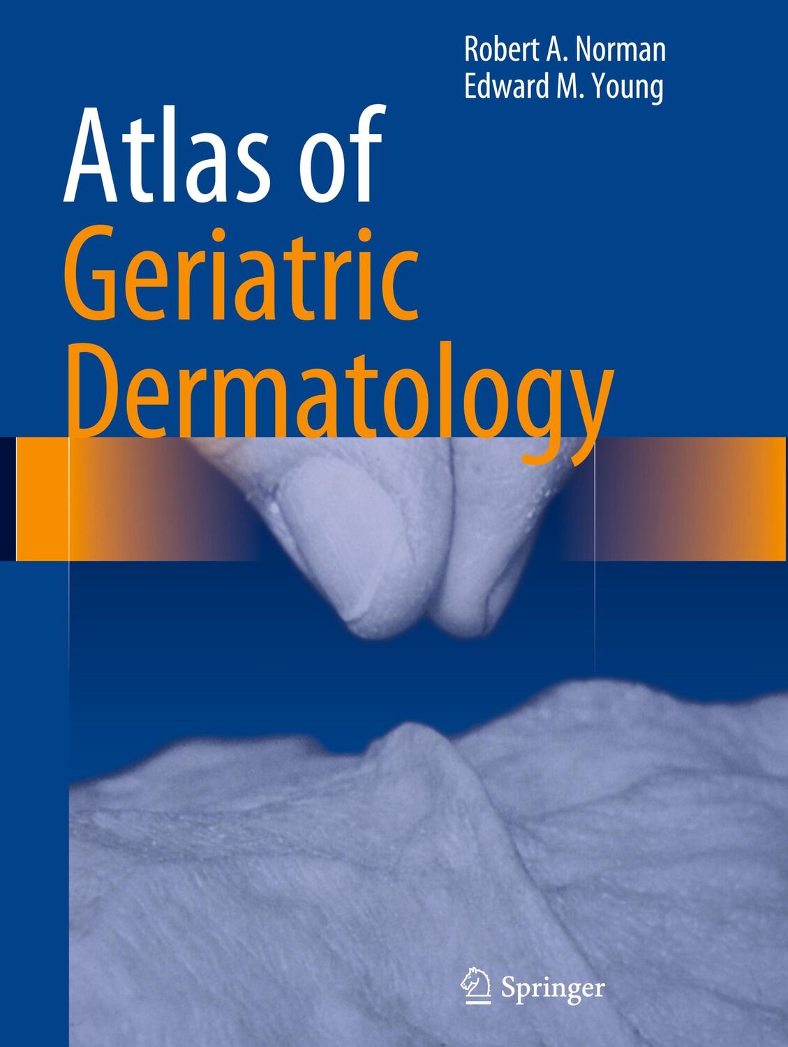 Cover: 9781447145783 | Atlas of Geriatric Dermatology | Jr Young (u. a.) | Buch | xxiv | 2013