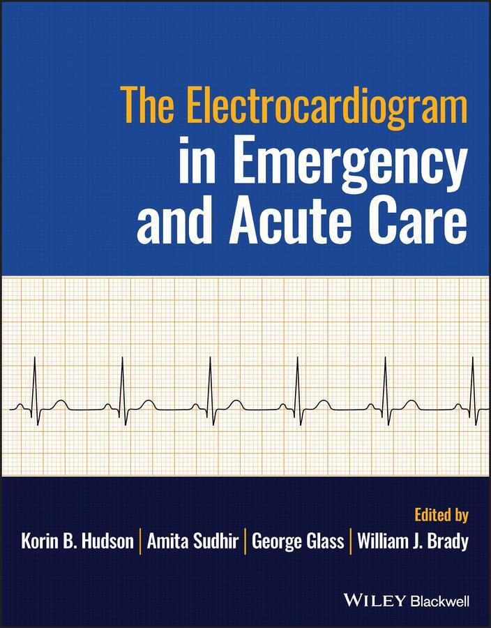 Cover: 9781119266891 | The Electrocardiogram in Emergency and Acute Care | Hudson (u. a.)