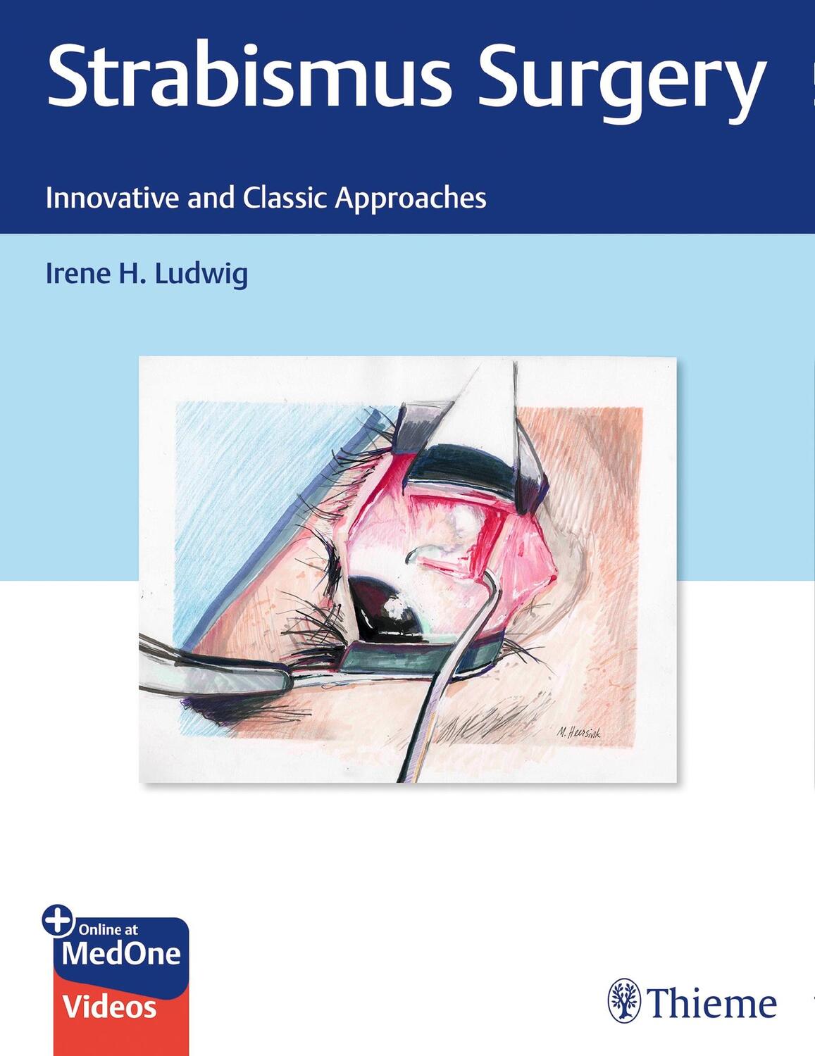 Cover: 9781626235267 | Strabismus Surgery | Innovative and Classic Approaches | Irene Ludwig