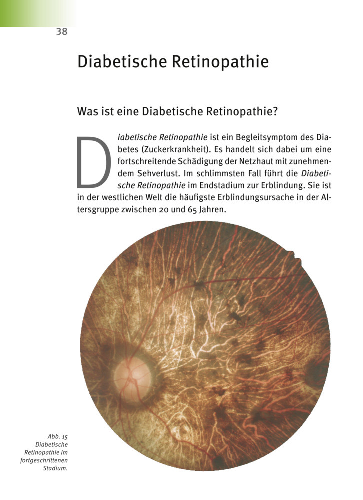 Bild: 9783981252026 | Makula-Degeneration, Diabetische Retinopathie | Andreas Nieswandt