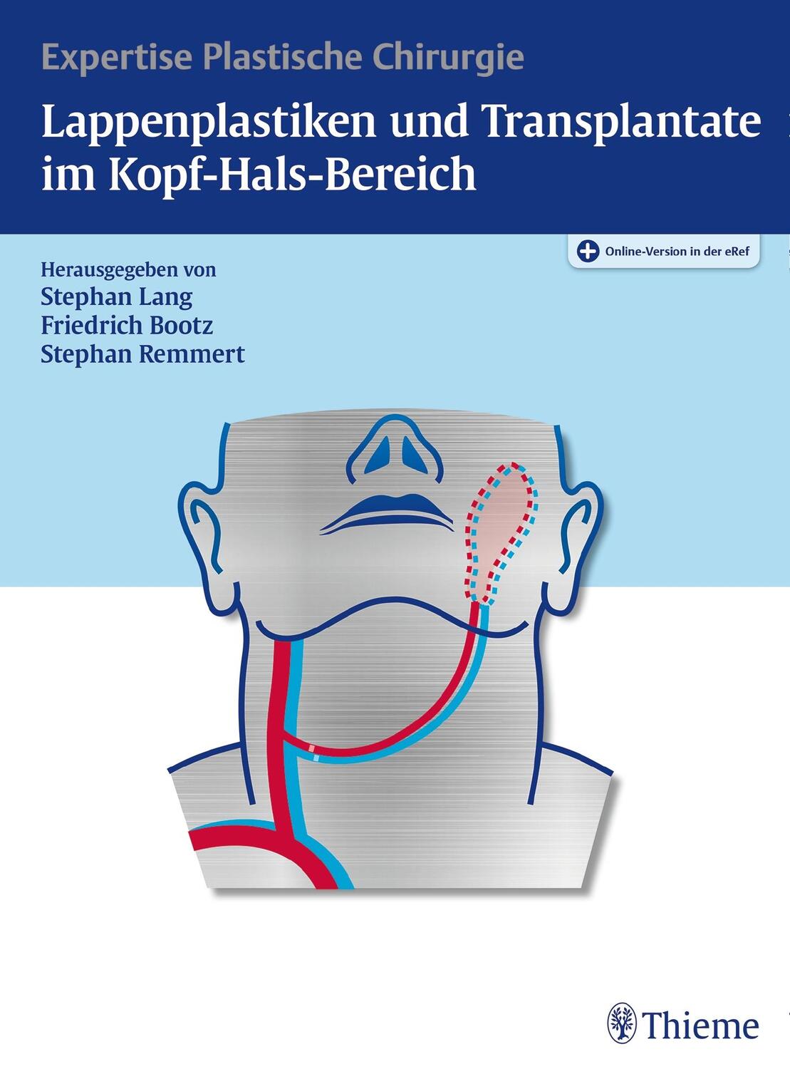 Cover: 9783131981615 | Lappenplastiken und Transplantate im Kopf-Hals-Bereich | Lang (u. a.)