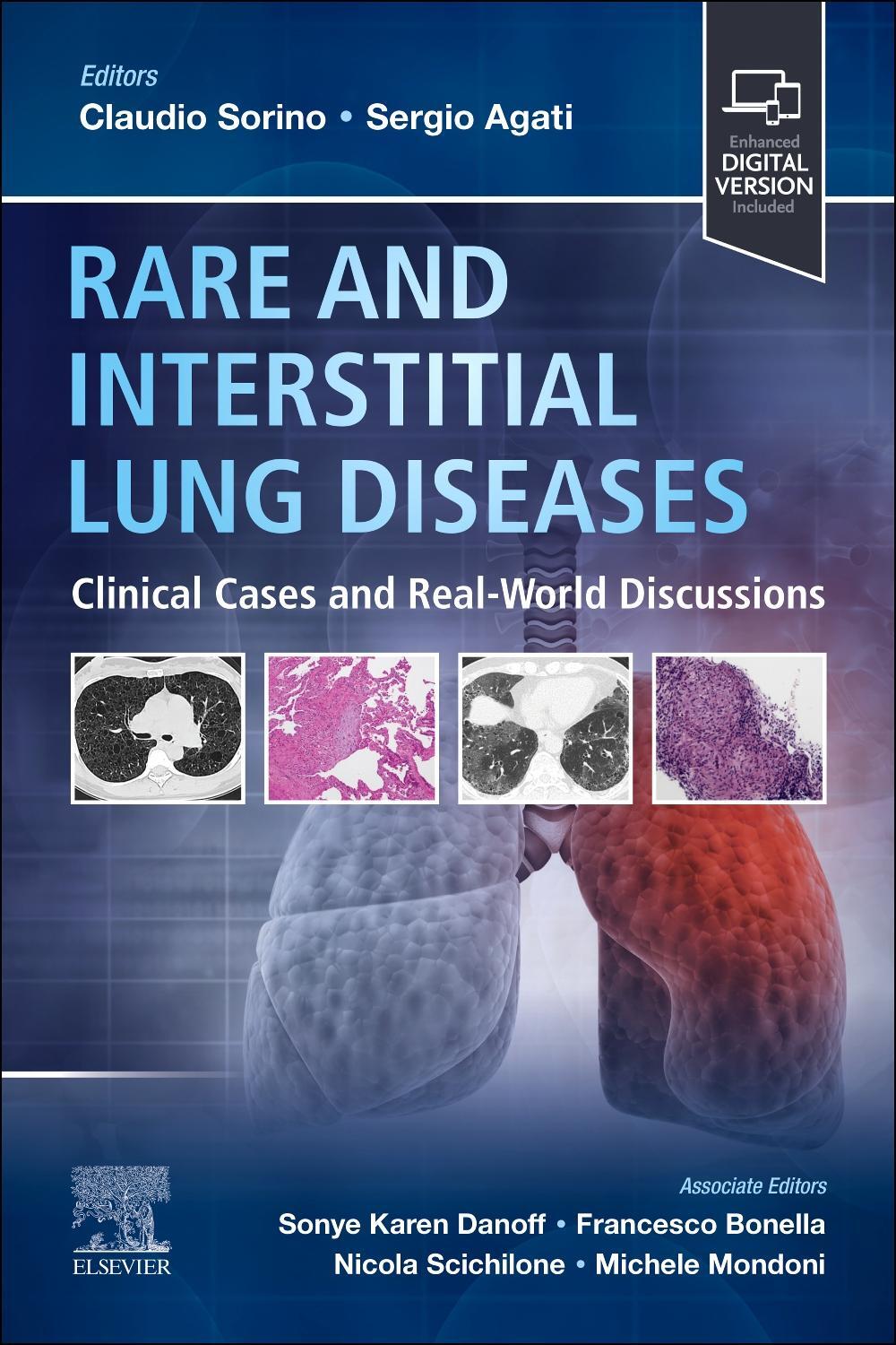 Cover: 9780323935227 | Rare and Interstitial Lung Diseases | Claudio Sorino (u. a.) | Buch