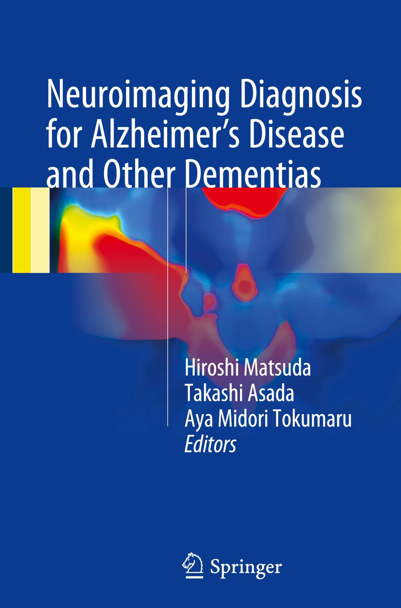 Cover: 9784431551324 | Neuroimaging Diagnosis for Alzheimer's Disease and Other Dementias