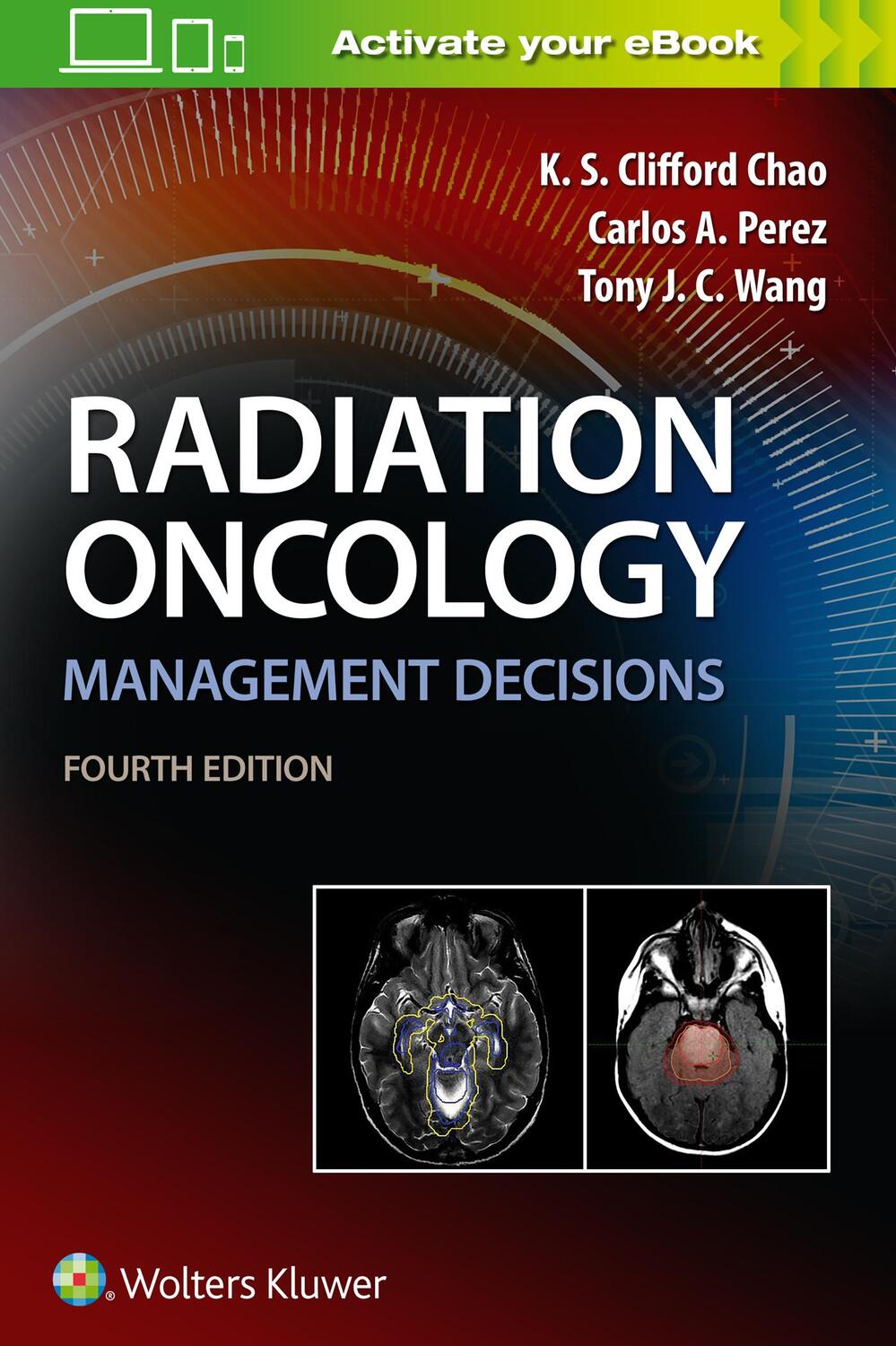 Cover: 9781496391094 | Radiation Oncology Management Decisions | Carlos A. Perez (u. a.)