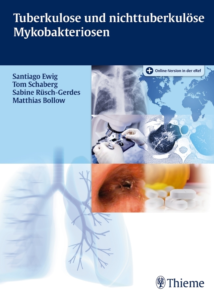Cover: 9783132045811 | Tuberkulose und nicht tuberkulöse Mykobakteriosen | Bundle | 1 Buch