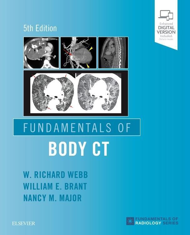 Cover: 9780323608329 | Fundamentals of Body CT | W. Richard Webb (u. a.) | Taschenbuch | 2019