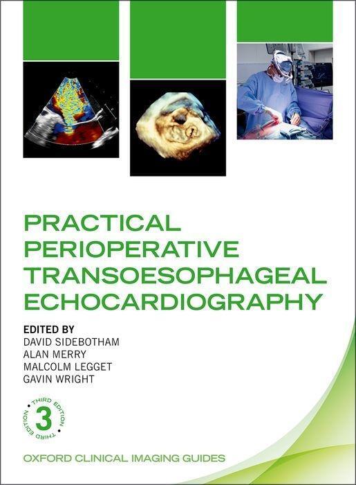 Cover: 9780198759089 | Practical Perioperative Transoesophageal Echocardiography | Buch