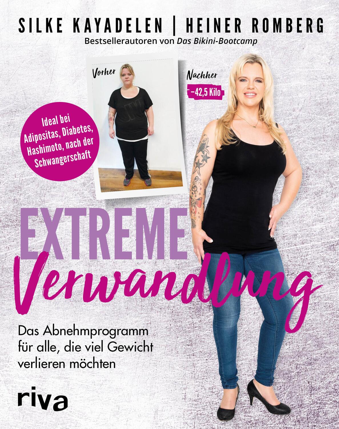 Cover: 9783742306920 | Extreme Verwandlung | Silke Kayadelen (u. a.) | Taschenbuch | Deutsch