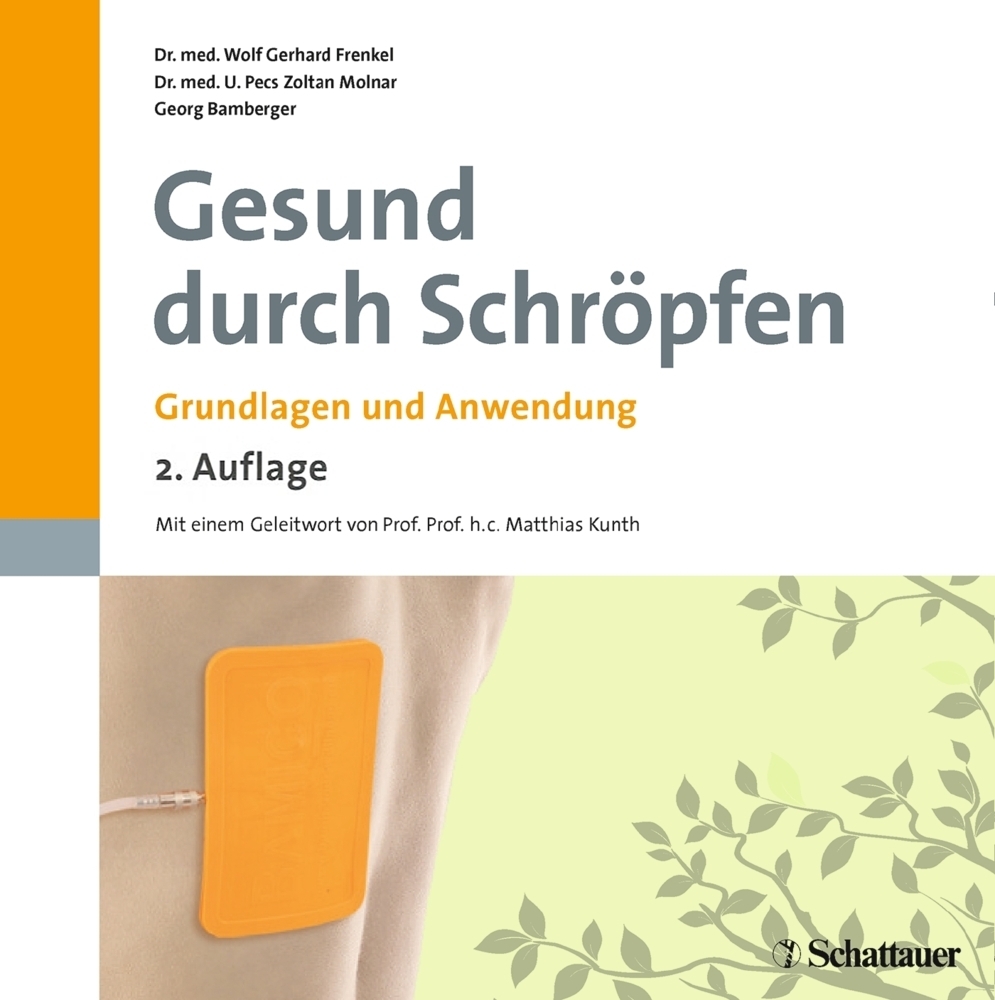 Cover: 9783794530854 | Gesund durch Schröpfen | Grundlagen und Anwendung | Frenkel (u. a.)