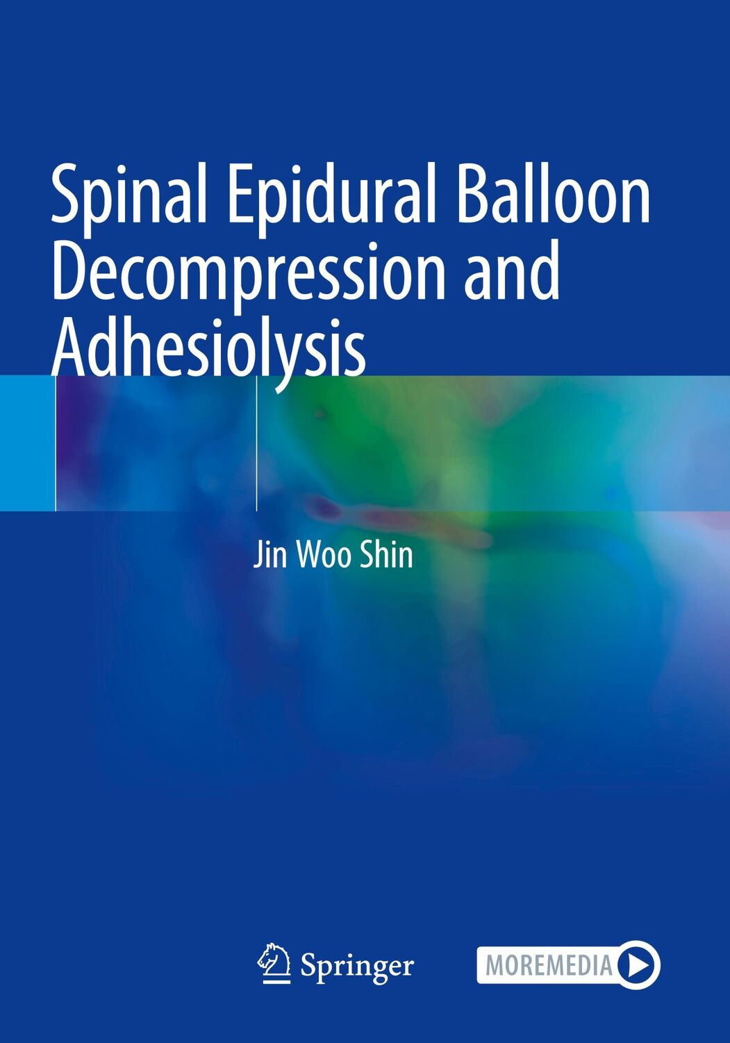 Cover: 9789811572678 | Spinal Epidural Balloon Decompression and Adhesiolysis | Jin Woo Shin