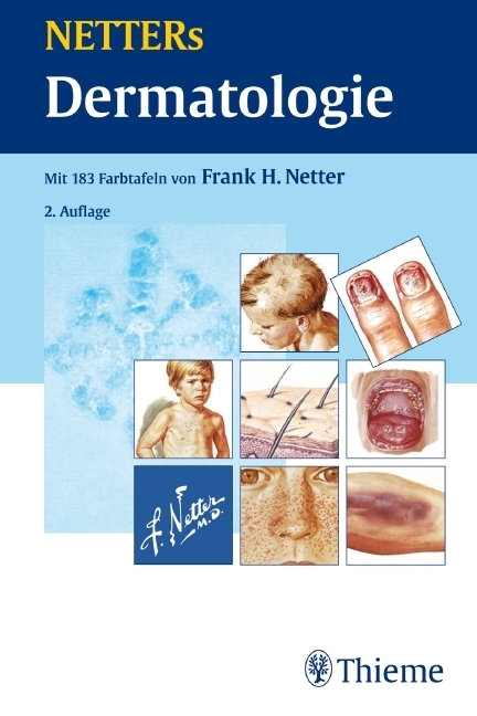 Cover: 9783131410023 | NETTERs Dermatologie | Frank H. Netter | Buch | 416 S. | Deutsch