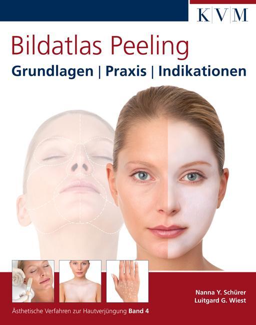 Cover: 9783940698742 | Bildatlas Peeling | Grundlagen Praxis Indikationen | Schürer (u. a.)