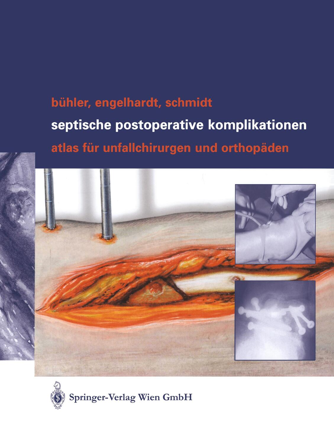 Cover: 9783211838112 | Septische postoperative Komplikationen | Matthias Bühler (u. a.) | X