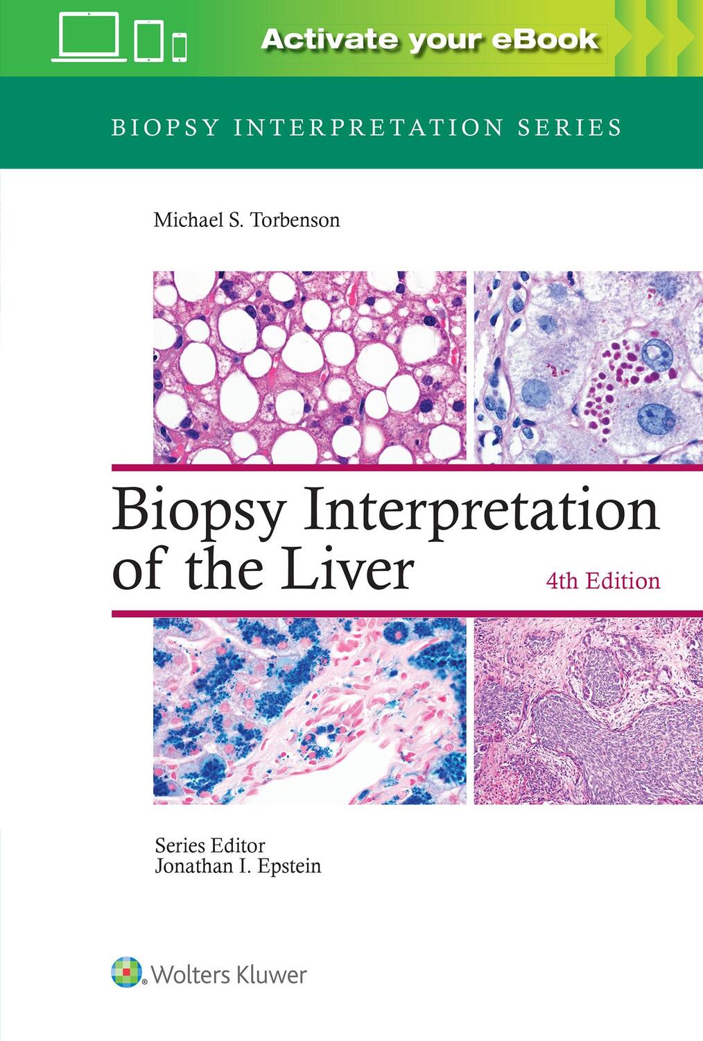 Cover: 9781975157296 | Biopsy Interpretation of the Liver | Michael Torbenson | Buch | 2021