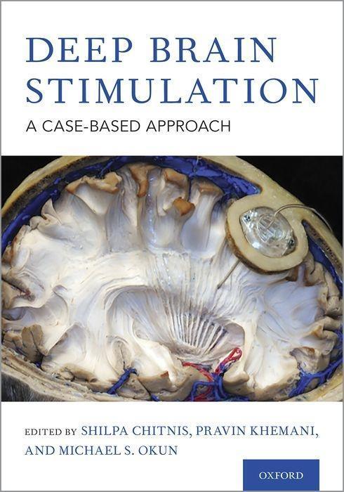 Cover: 9780190647209 | Deep Brain Stimulation | A Case-Based Approach | Chitnis (u. a.)