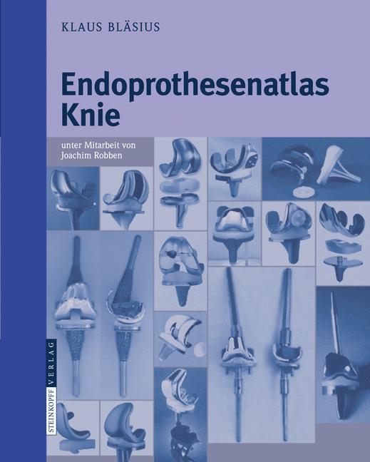 Cover: 9783798517660 | Endoprothesenatlas Knie | Klaus Bläsius | Taschenbuch | Paperback