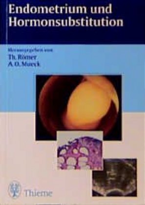 Cover: 9783131050014 | Endometrium und Hormonsubstitution | Thomas Römer (u. a.) | Buch