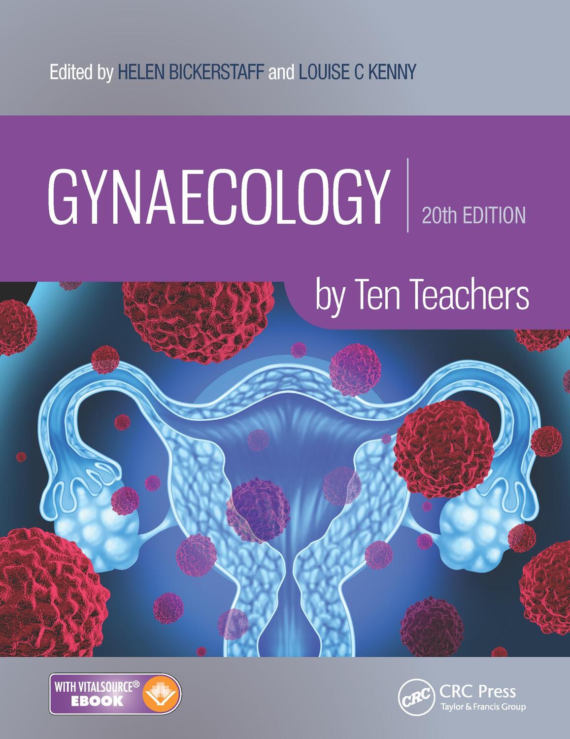 Cover: 9781498744287 | Gynaecology by Ten Teachers | by Ten Teachers | Taschenbuch | Englisch