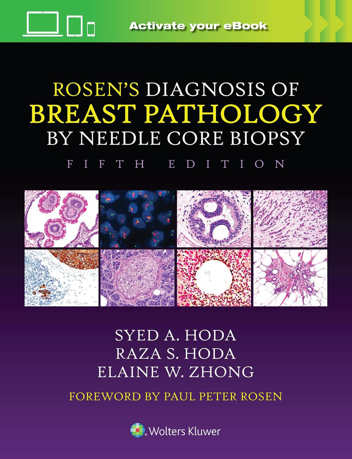 Cover: 9781975198367 | Rosen's Diagnosis of Breast Pathology by Needle Core Biopsy | Buch