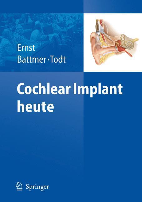 Cover: 9783540882350 | Cochlear Implant heute | Arne Ernst (u. a.) | Taschenbuch | Paperback